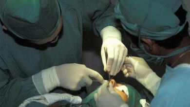 صورة شكا من احتقان في الأنف .. فاكتشف الأطباء مفاجأة مذهلة