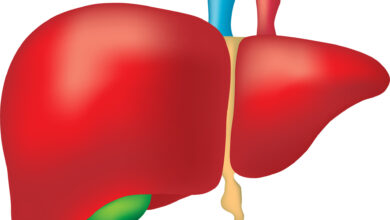 صورة أعراض بسيطة تنذر بأمراض خطيرة في الكبد